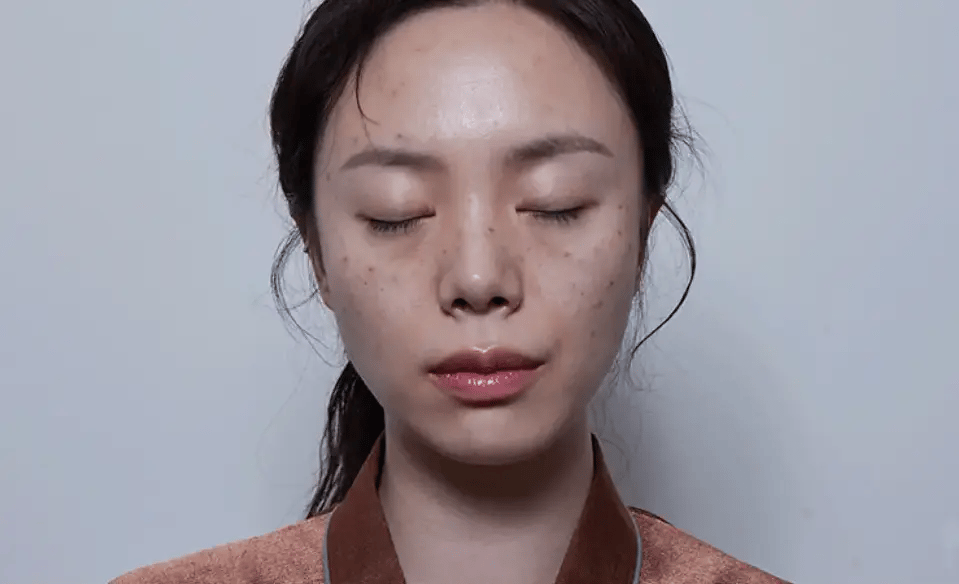 Visible Transformation—Radiance & Youth Restored